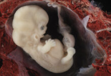 Senate Moves to Curb Access to the Abortion Pill