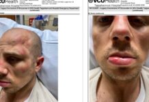 Ryan Samsel’s Newly Public Court Filing Details Beating and Denied Medical Care in Jail