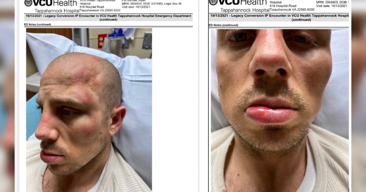 Ryan Samsel’s Newly Public Court Filing Details Beating and Denied Medical Care in Jail