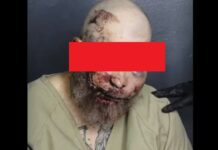 New Mugshot Released for Florida Man Accused of Fighting Police